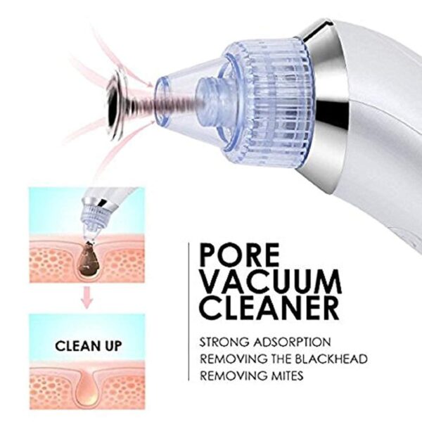 Electric Pore Vacuum Cleaner – Blackhead Remover with 4 Suction Heads - Image 2